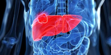 Bệnh ung thư gan – những điều bạn nhất định cần biết