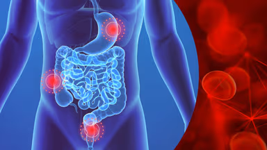 Bệnh xuất huyết tiêu hóa: Nguyên nhân và triệu chứng