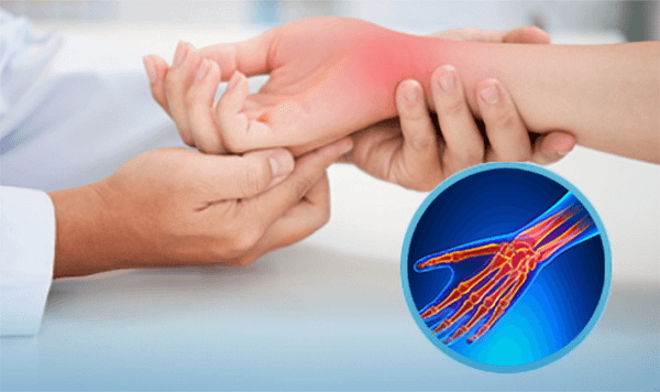 Nên đi khám sớm nếu nhận thấy các triệu chứng của hội chứng ống cổ tay