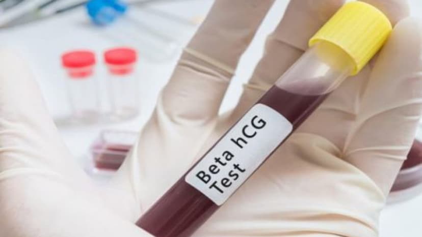 Chi phí thực hiện xét nghiệm beta HCG tại nhà giá bao nhiêu?