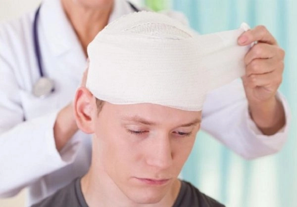 Dấu hiệu u não lành tính là gì