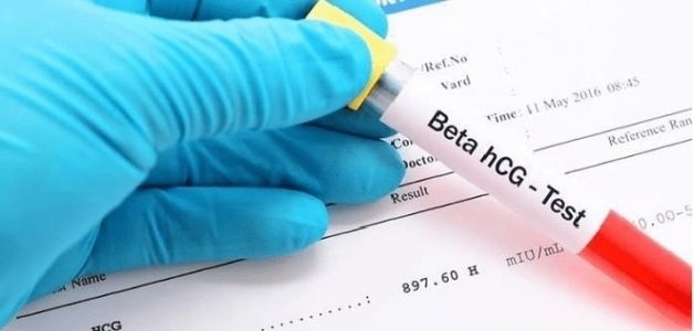 Xét nghiệm beta HCG là gì?