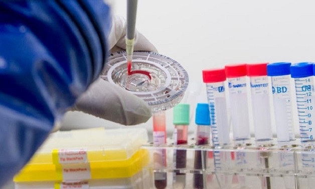 Xét nghiệm viêm gan B tại nhà là gì?