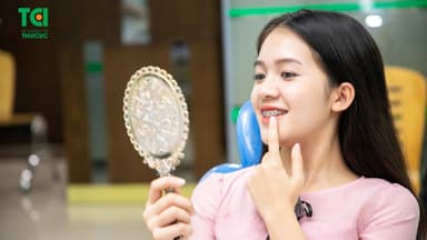 Ai cần niềng răng? Niềng răng ở đâu tốt Hà Nội?