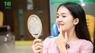 Ai cần niềng răng? Niềng răng ở đâu tốt Hà Nội?