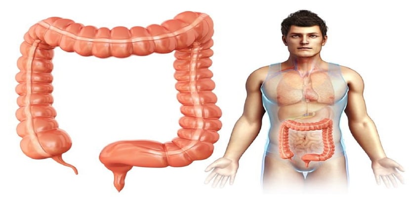 Triệu chứng đau đại tràng và hệ lụy của đau đại tràng