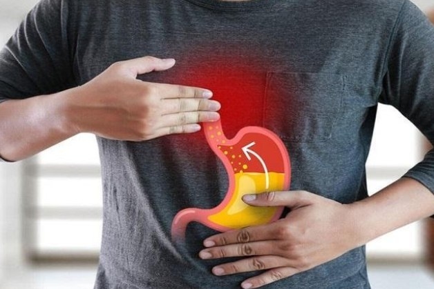 Trào ngược dạ dày thực quản