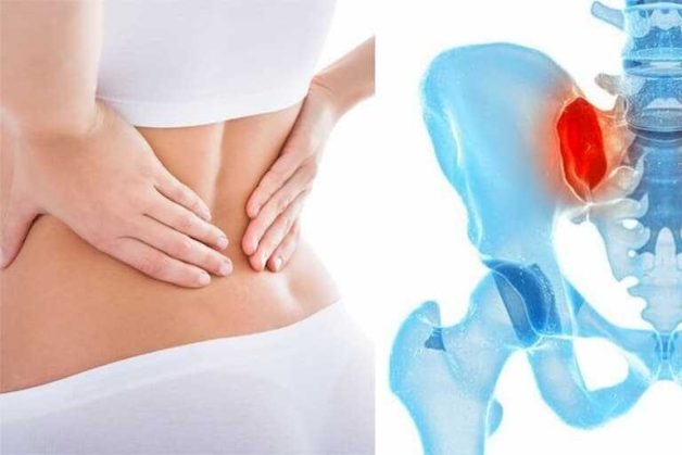 Đau khớp cùng chậu có thể gặp ở bất cứ ai, đặc biệt là phụ nữ trong độ tuổi sinh sản