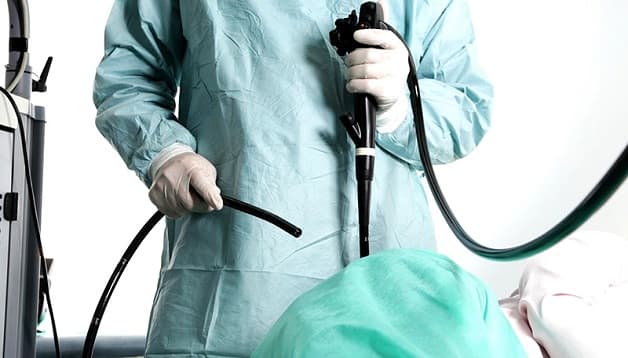 nội soi trong khám sàng lọc ung thư đại trực tràng