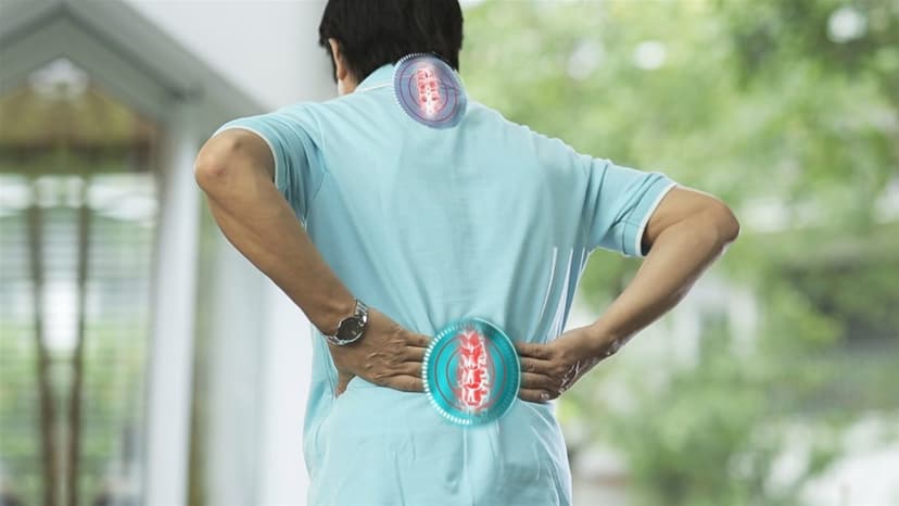 Vôi hóa cột sống và phương pháp phòng ngừa