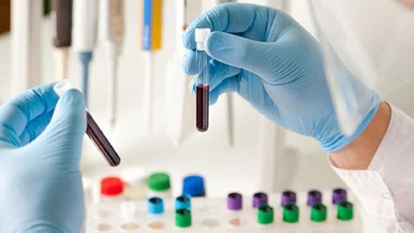 Tầm soát ung thư gan mật bao gồm những gì?