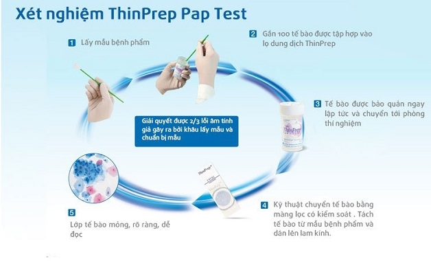 xét nghiệm thinprep