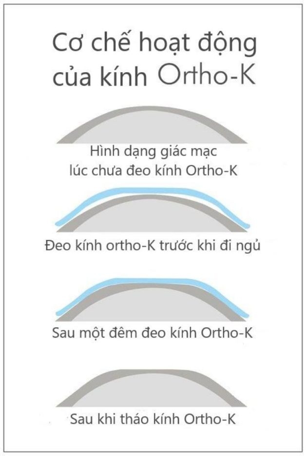 bệnh viễn thị