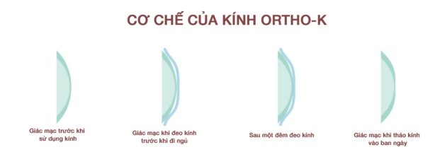 kính ortho k
