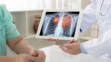 Khám tầm soát ung thư phổi hết bao nhiêu tiền?