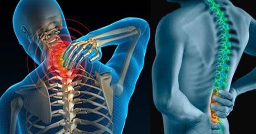 Điều trị vôi hóa cột sống và những điều cần lưu ý