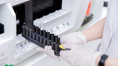 Làm gì khi chỉ số xét nghiệm dấu ấn tầm soát ung thư phổi cao