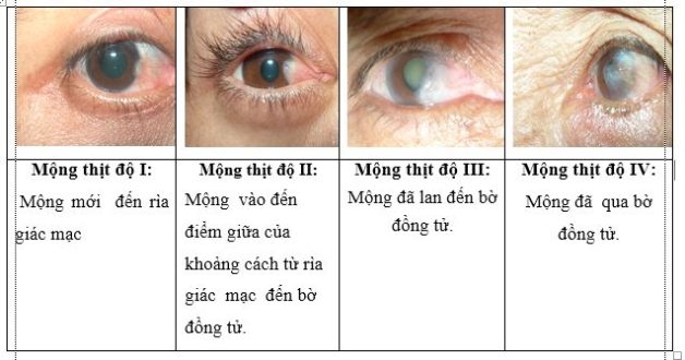 bệnh mộng thịt