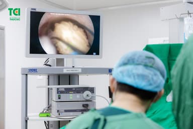 Các phương pháp điều trị sỏi tiết niệu công nghệ cao