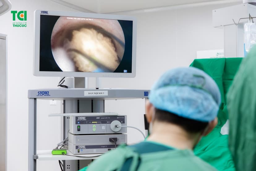 Các phương pháp điều trị sỏi tiết niệu công nghệ cao