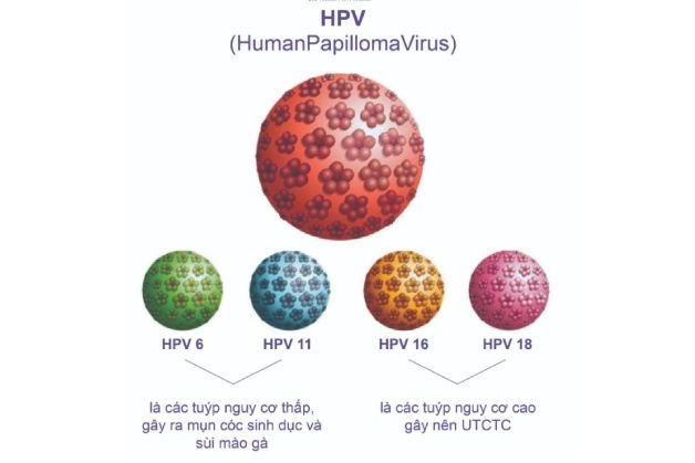 Mắc virus HPV do đâu