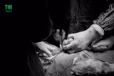 Thực hiện phẫu thuật u xơ tử cung như thế nào?