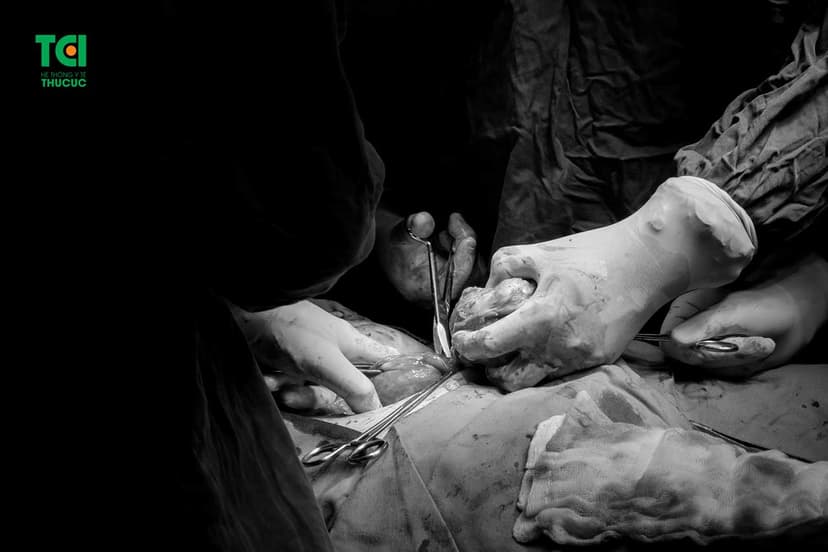 Thực hiện phẫu thuật u xơ tử cung như thế nào?