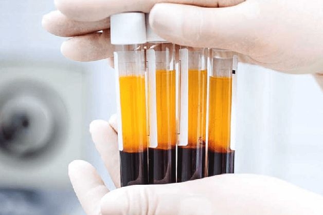 Khám tầm soát ung thư đại tràng