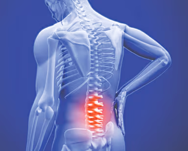 Thoái hóa cột sống thắt lưng hay gặp ở đối tượng nào?