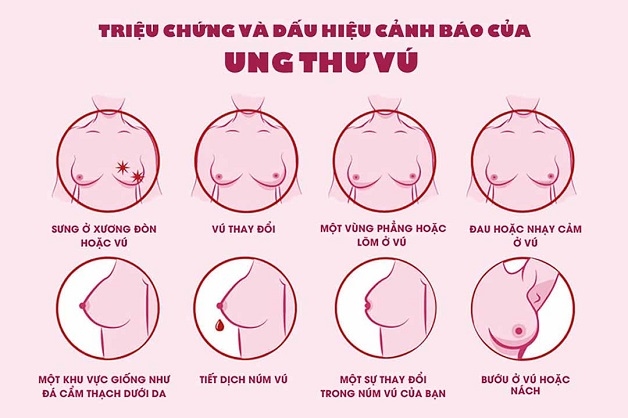 dấu hiệu ung thư vú