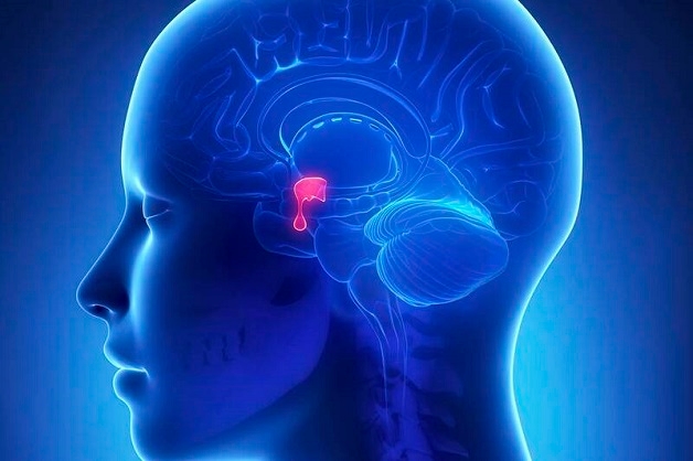 Đau nửa đầu thường xuyên coi chừng u tuyến yên, đột quỵ tuyến yên