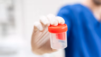 Cách lấy mẫu xét nghiệm tinh dịch đồ chính xác nhất