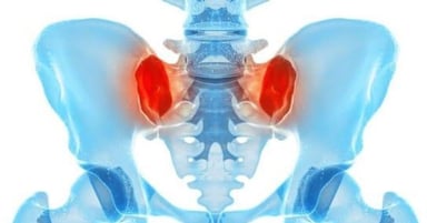 Tìm hiểu về viêm khớp vùng xương chậu ở phụ nữ