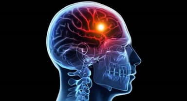 Cần làm gì khi phát hiện bị thiếu máu não?