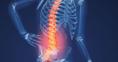 Cách điều trị bệnh thoái hóa đốt sống lưng hay được áp dụng