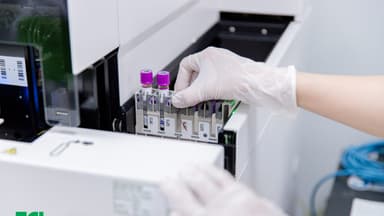 Chỉ số tầm soát ung thư buồng trứng CA 125 là gì?