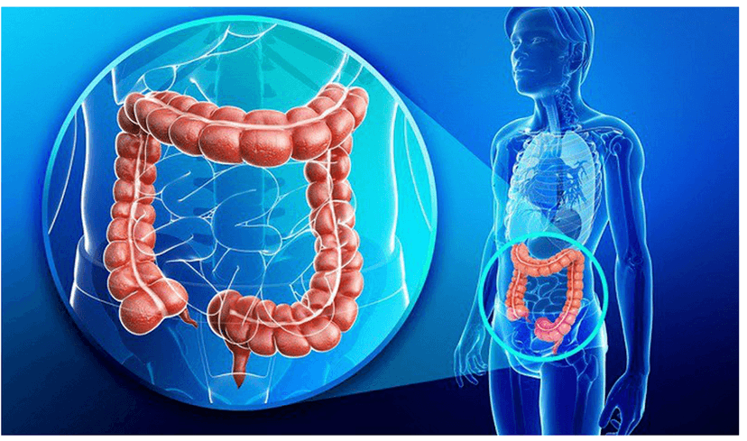 Những biểu hiện của bệnh đại tràng cần biết
