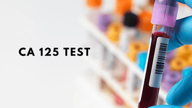 Điều cần biết chỉ số tầm soát ung thư buồng trứng CA 125