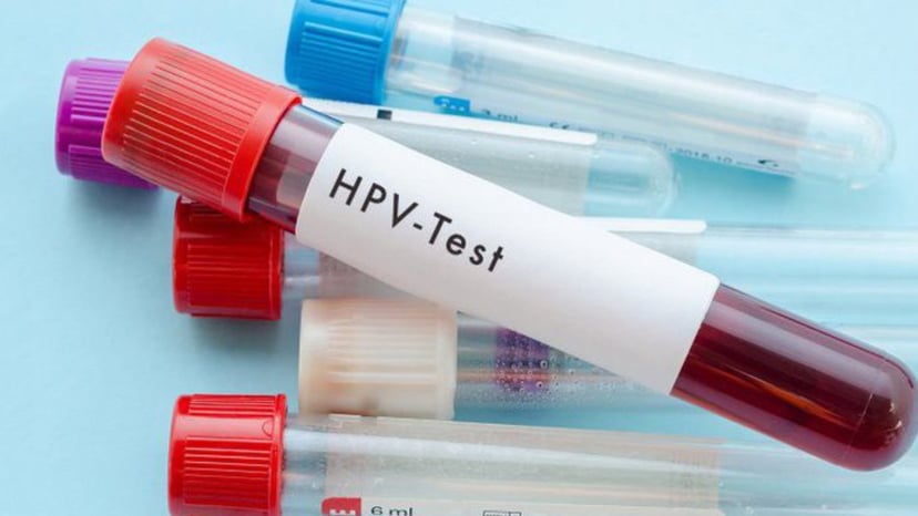 Phương pháp tầm soát ung thư cổ tử cung HPV chị em cần biết