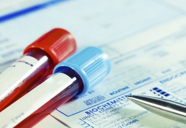 Vai trò của chỉ số SCC