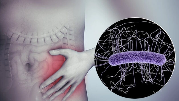 Bệnh viêm đại tràng màng giả gây ra bởi vi khuẩn Clostridium difficile