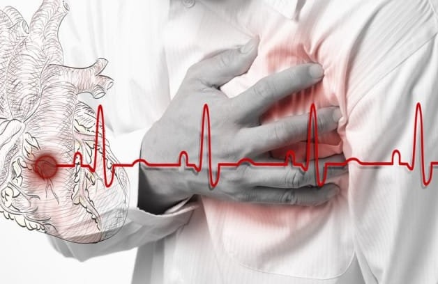 Suy tim cấp chủ yếu đa phần ở những bệnh nhân có bệnh nền về tim mạch