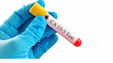 Tầm soát ung thư vú qua xét nghiệm máu có đạt hiệu quả?