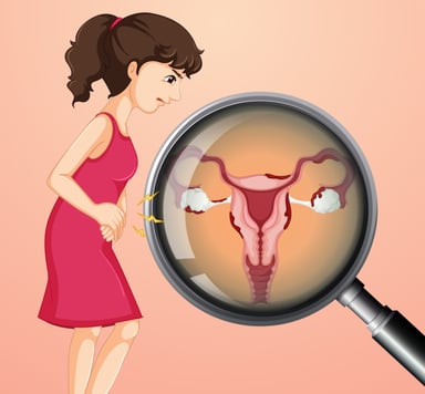 Tìm hiểu phương pháp điều trị ung thư buồng trứng