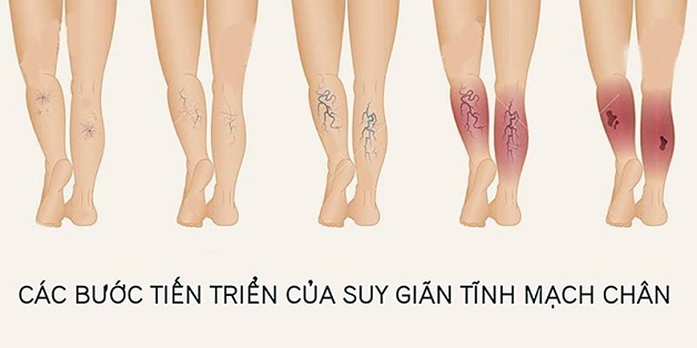 cách dễ ngủ cho người mất ngủ