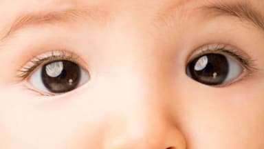 Nhận biết sớm dấu hiệu trẻ bị lác mắt và hướng điều trị