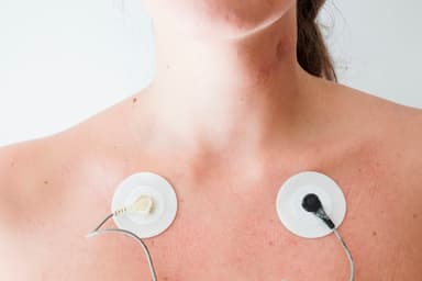 Điện tâm đồ ECG trong chẩn đoán bệnh tim mạch