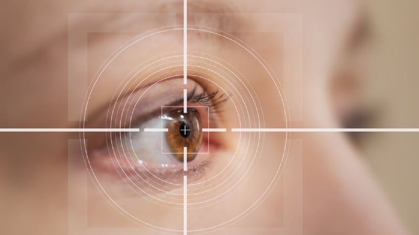 Phẫu thuật tật khúc xạ và những thông tin cần biết