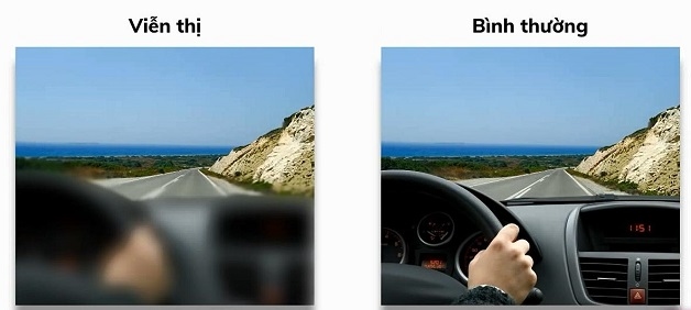 viễn thị và loạn thị