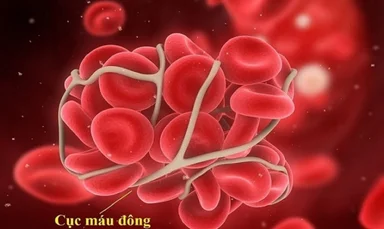 Xơ gan hạ natri máu, biến chứng rối loạn đông máu
